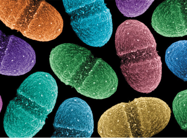 Бактерии Enterococcus faecalis могут производить электричество. 13413.jpeg Бактерии Enterococcus faecalis могут производить электричество. 13413.jpeg